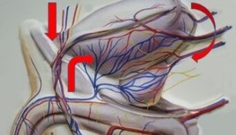 Varicose veins of the pelvic veins