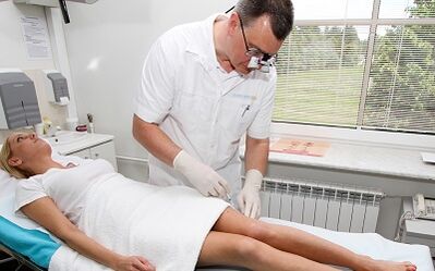 How to treat veins varicose veins