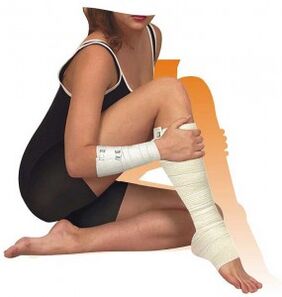 Additional therapy for varicose veins