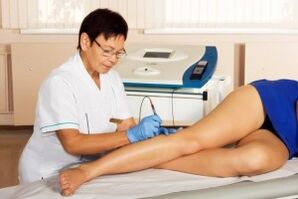 What are the veins varicose veins